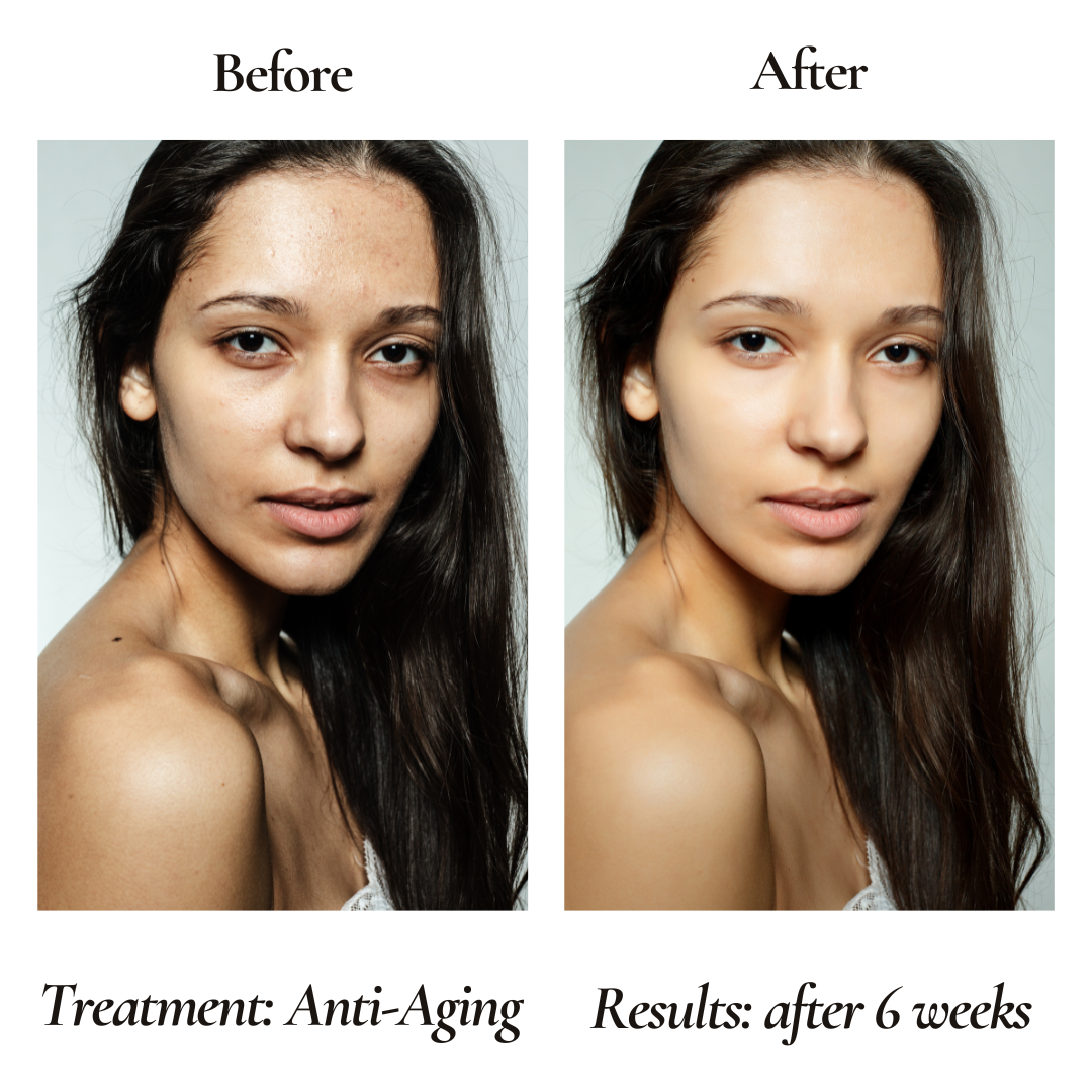 Anti-Aging Organic Facial Moisturizer - FOR WOMEN